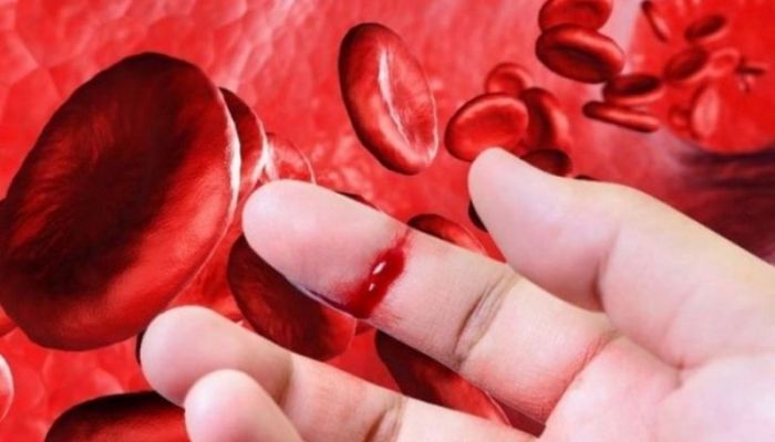 Những nguyên nhân phổ biến dẫn tới bệnh thiếu máu là gì?
