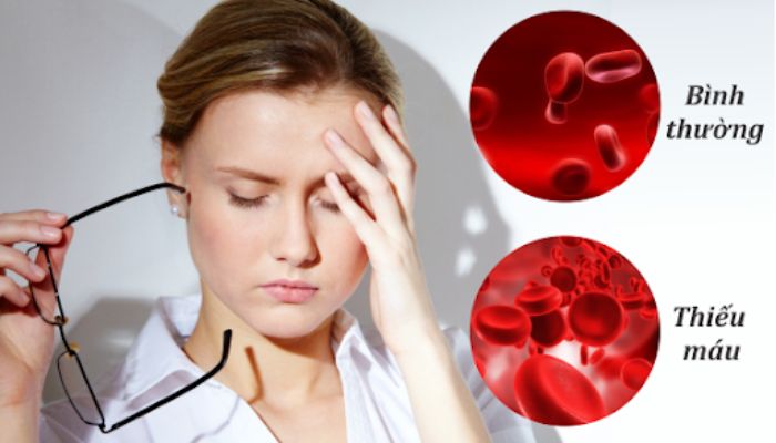 Thiếu máu là gì? Dấu hiệu nhận biết của bệnh thiếu máu